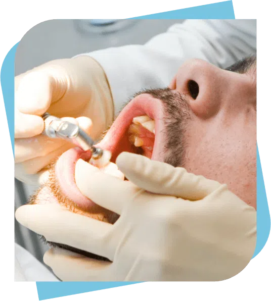 man having his teeth polished