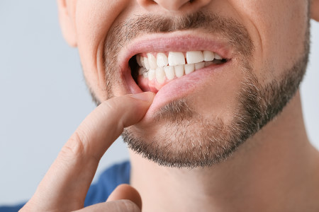 man showing his swollen gums